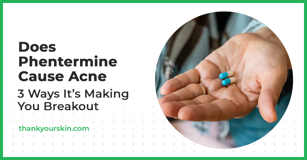 Does Phentermine Cause Acne? (A Must-Read!)