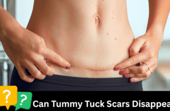 Do Tummy Tuck Scars Disappear—Or Can They Become a Masterpiece?