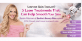 Uneven Skin Texture? 5 Laser Treatments That Can Help Smooth Your Skin